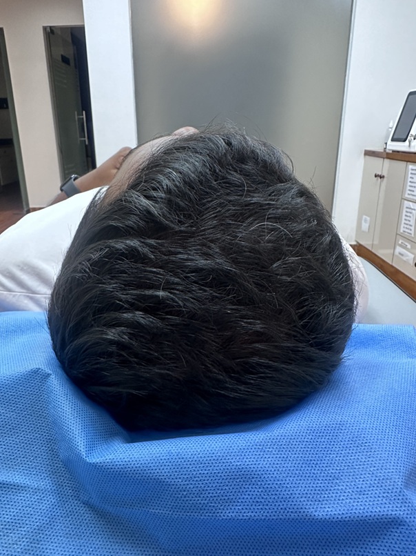 After