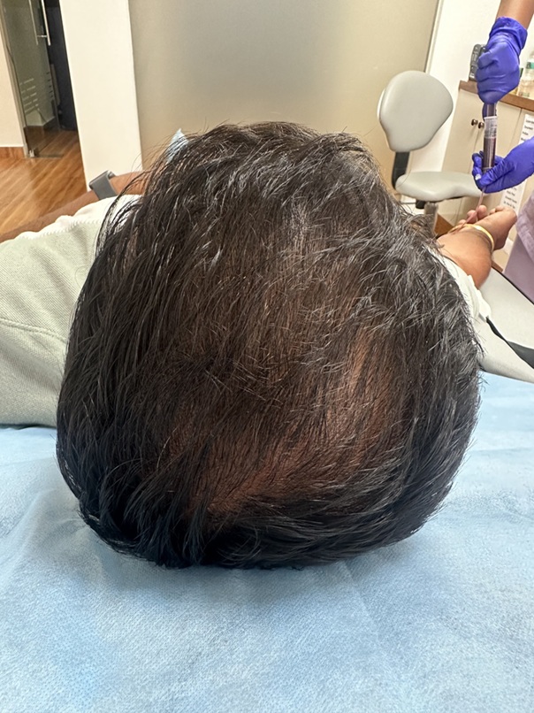 Before