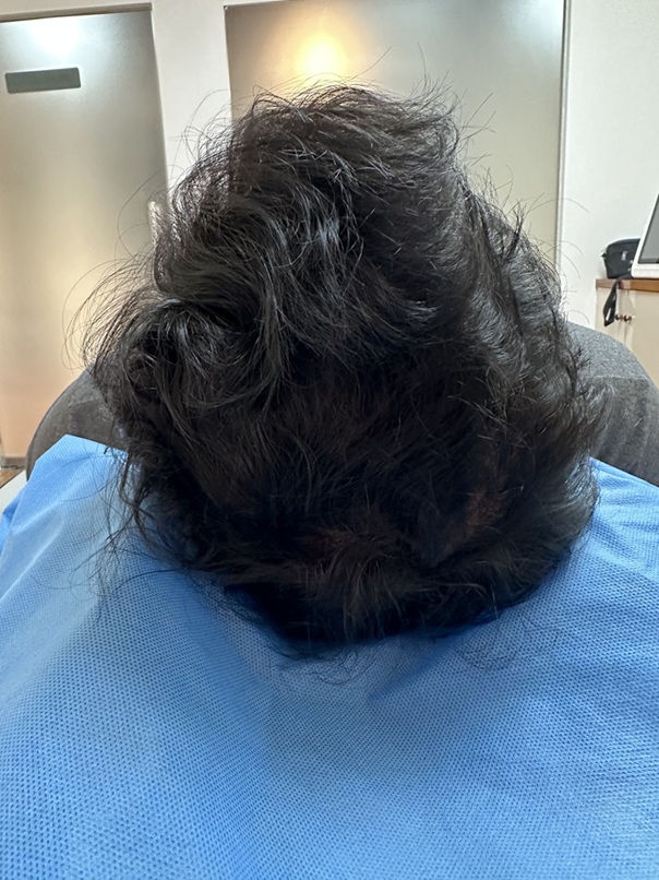 After