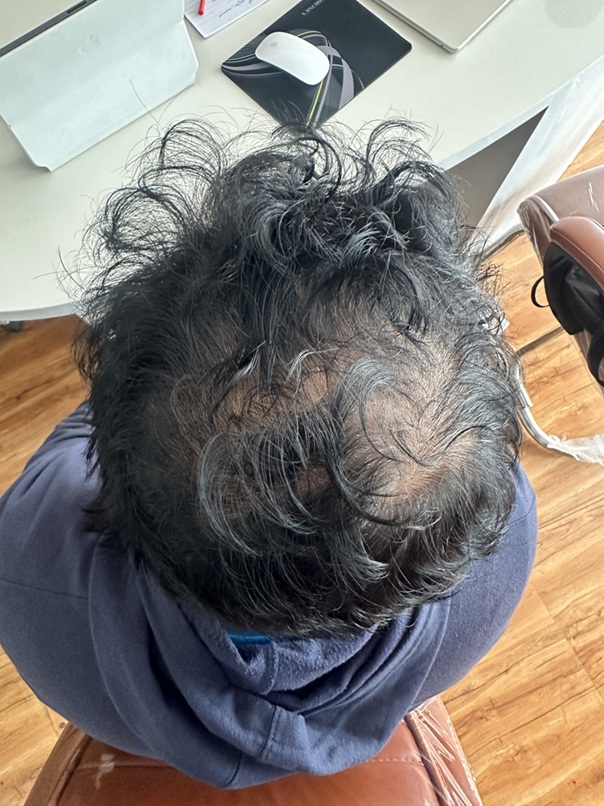 Before