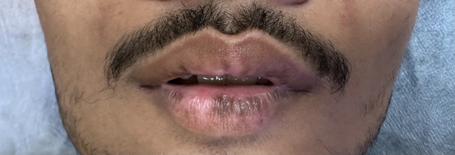 Before