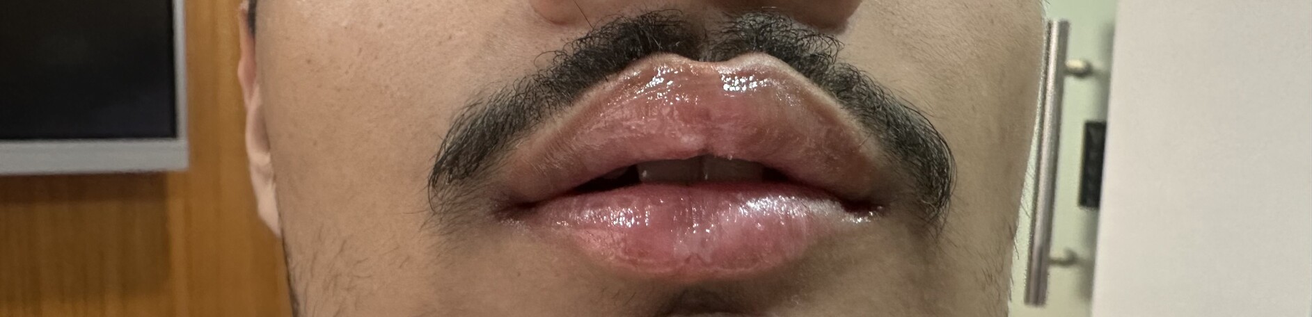 After